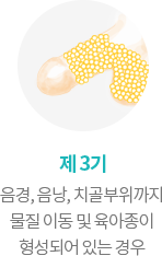 제 3기. 음경, 음낭, 치골부위까지 물질 이동 및 육아종이 형성되어 있는 경우
