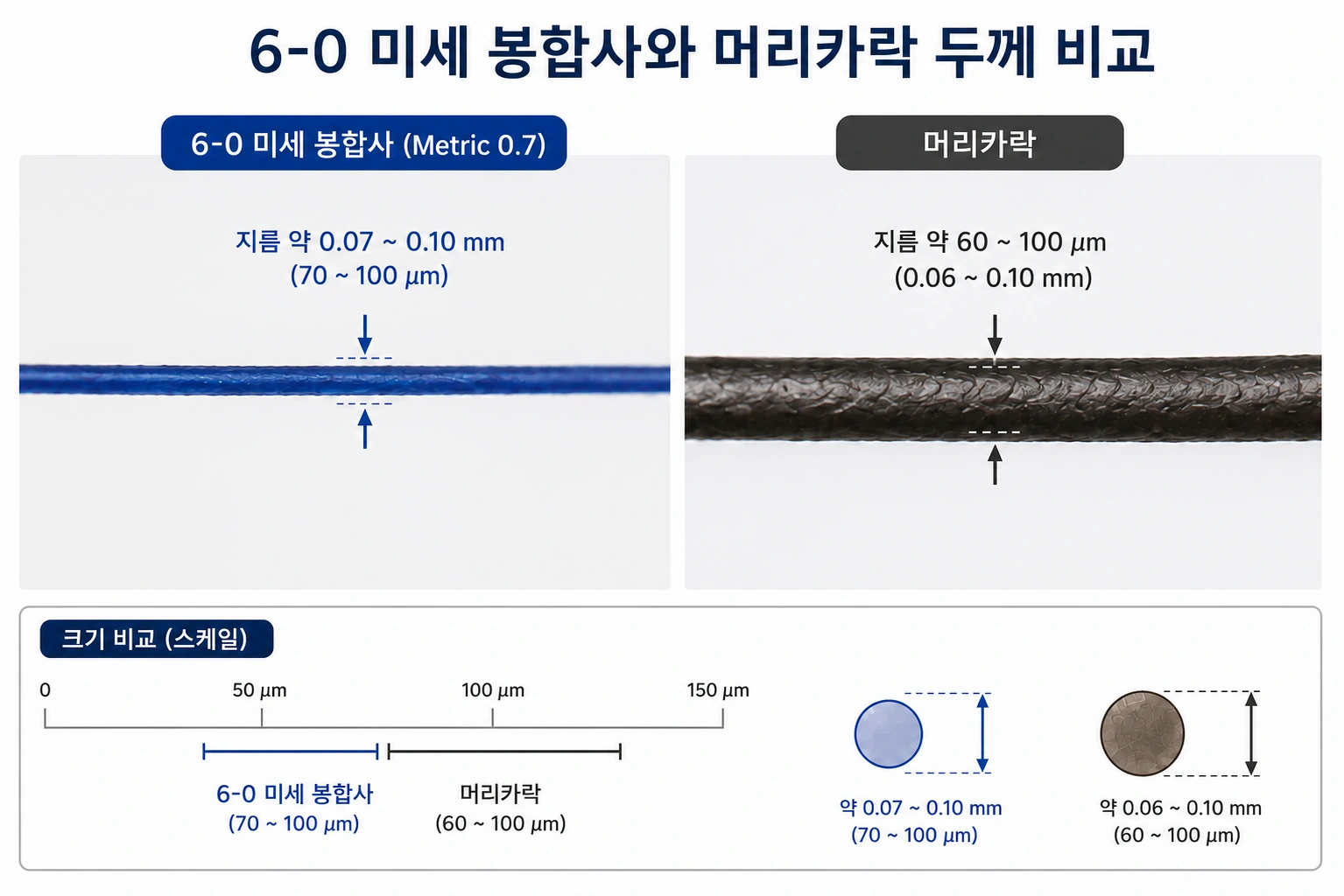6-0 미세 봉합사와 머리카락 두께 비교 이미지